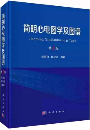 简明心电图学及图谱（第2版）